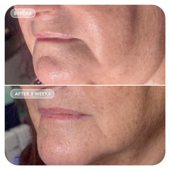 GLP-1 4D Skin Rebound Complex