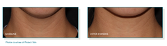 Pep Up® Collagen Boost Face & Neck Serum