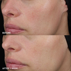 Barrier Repair Recovery Balm
