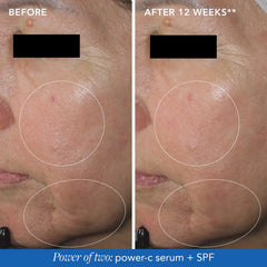 Image MD Restoring Power C Serum