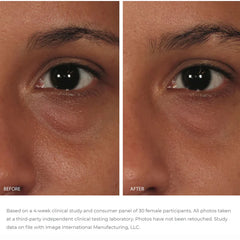 Ormedic Balancing Eye Lift Gel