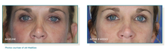 Pep Up® Collagen Boost Face & Neck Serum