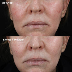 Biotech Longevity Creme